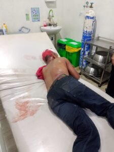 Sekuriti Gudang di Labuhan Deli Diduga Jadi Korban Pengeroyokan, Alami Luka Bacok di Kepala