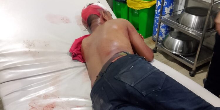 Sekuriti Gudang di Labuhan Deli Diduga Jadi Korban Pengeroyokan, Alami Luka Bacok di Kepala