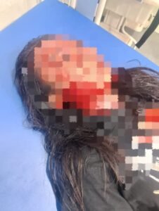 Diduga Jadi Korban Begal, Dua Warga Kritis Dilarikan ke Rumah Sakit