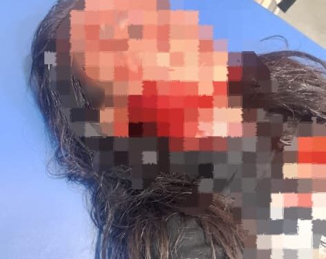 Diduga Jadi Korban Begal, Dua Warga Kritis Dilarikan ke Rumah Sakit