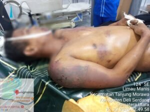 Diduga Tewas Usai Diamankan, Keluarga Minta Kasus Daniel Situmeang Diusut Tuntas