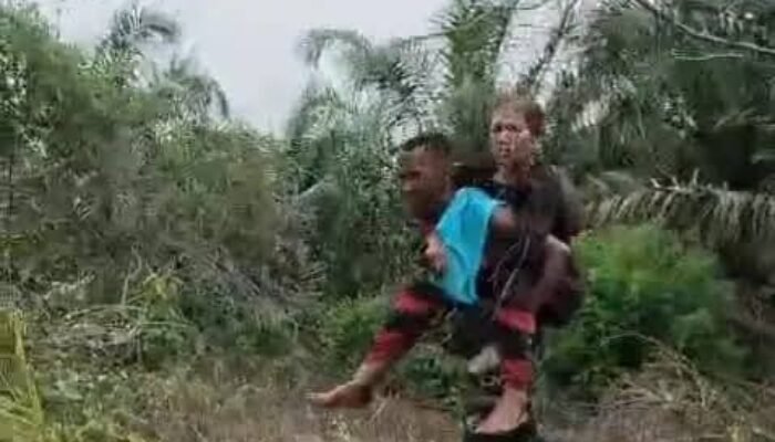 Gajah Liar Injak Petani Perempuan di Aceh Selatan hingga Patah Kaki